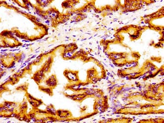 Polyclonal Rabbit anti-Human GOLPH3 Antibody (IHC, WB)