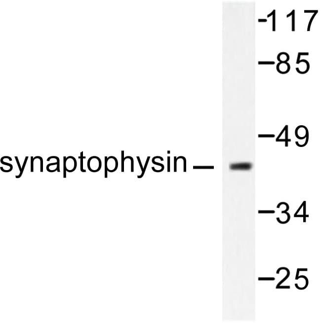 SYP / Synaptophysin Antibody (Leu128)