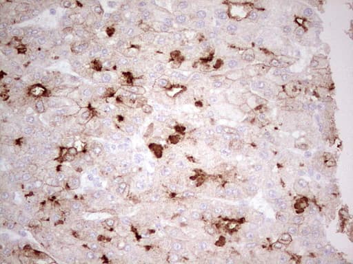 Monoclonal Mouse anti-Human ABCB1 / MDR1 / P Glycoprotein Antibody (clone OTI11D2, aa995-1280, IHC)