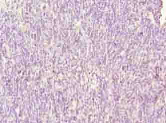 SH3BGRL3 Antibody