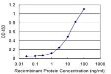 Monoclonal Mouse anti-Human IL37 Antibody (clone 6A6, IHC, WB)