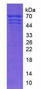 Human Fibrinogen Protein (Native His, N-Terminal)