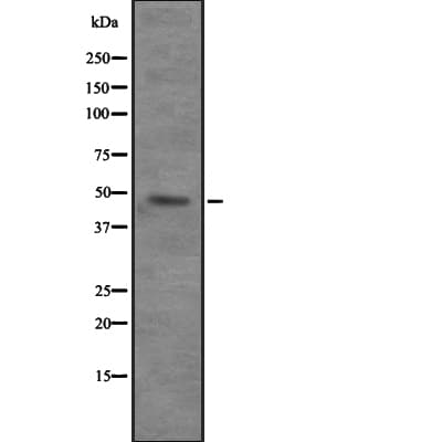 SKD1 / VPS4B Antibody