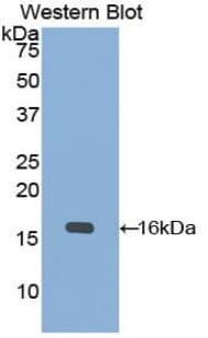 KRT15 / CK15 / Cytokeratin 15 Antibody (aa274-399)