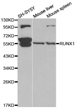 IHC-plus™ AML1 / RUNX1 Antibody (aa150-250)