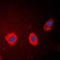 IHC-plus™ KRT17 / CK17 / Cytokeratin 17 Antibody (C-Terminus)