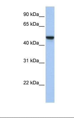APMAP / C20orf3 Antibody (aa74-123)