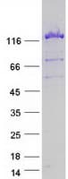 Human USP8 / UBPY Protein (Recombinant Myc-DDK (Flag))