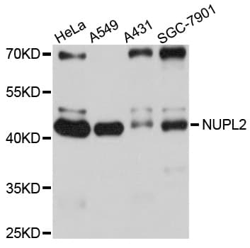 Polyclonal Rabbit anti-Human NUPL2 Antibody (WB)