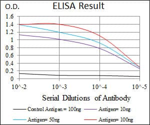 PathPlus™ KRT5 / CK5 / Cytokeratin 5 Antibody (aa158-272, clone 2C2)