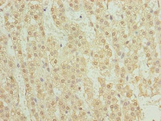 Polyclonal Rabbit anti-Human TRM6 / TRMT6 Antibody (IHC, WB)
