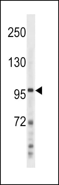 NFKB2 Antibody (aa848-874)