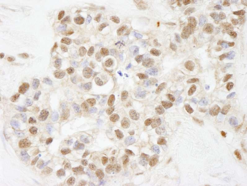 Polyclonal Rabbit anti-Human ARID1B / BAF250B Antibody (aa1850-1900, IHC)