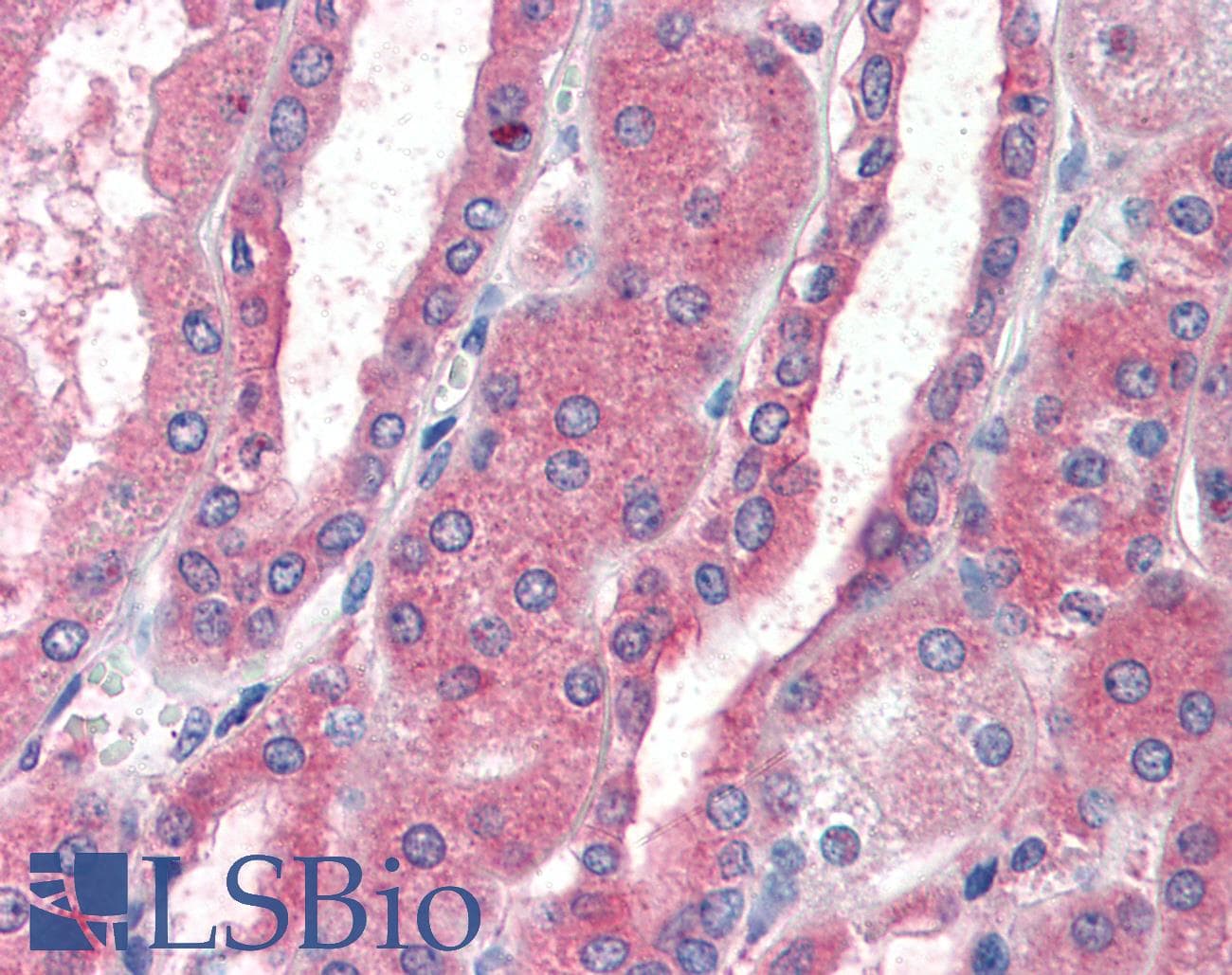 IHC-plus™ CXCR4 Antibody (aa14-40)