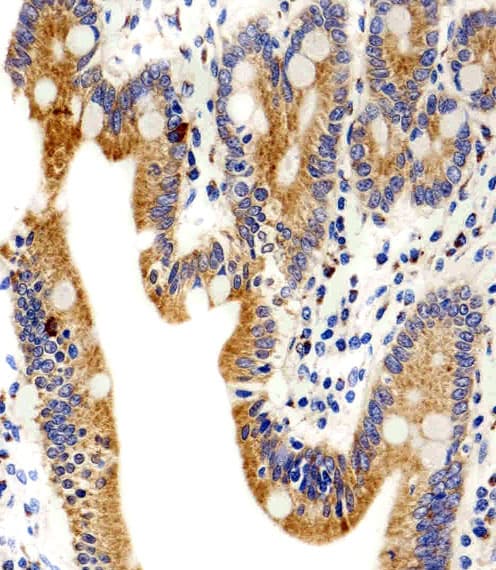 Polyclonal Rabbit anti-Human ADRA1D / Adrenoceptor alpha 1D Antibody (aa1-30, IHC, WB)