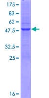Human HIST1H1C Protein (Recombinant GST)