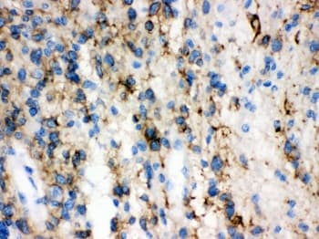 GAP43 Antibody (aa216-238)