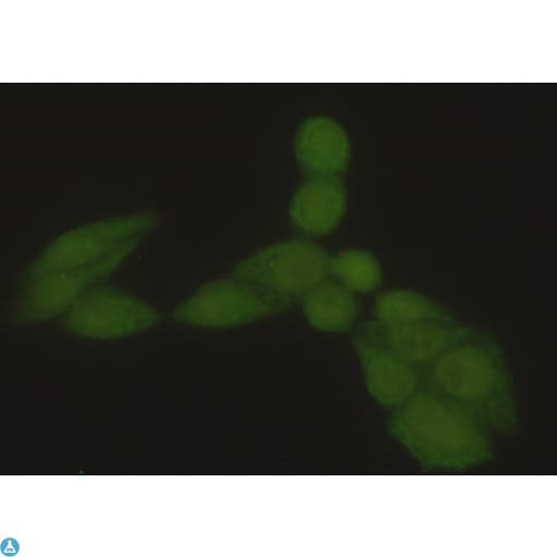 HSP70 / Heat Shock Protein 70 Antibody