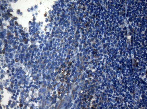 Monoclonal Mouse anti-Human AKT1 Antibody (clone OTI1D12, IHC, WB)