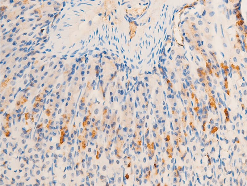 HSPB6 / HSP20 Antibody (phospho-Ser16)