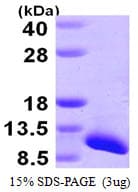 Human SNRPG Protein (Recombinant His)