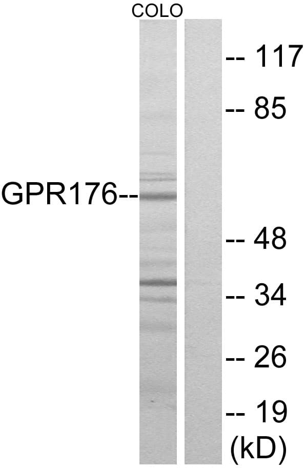 GPR176 Antibody (aa466-515)