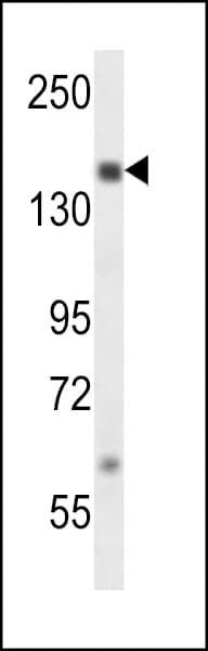 NCOA1 / SRC-1 Antibody (aa594-625)
