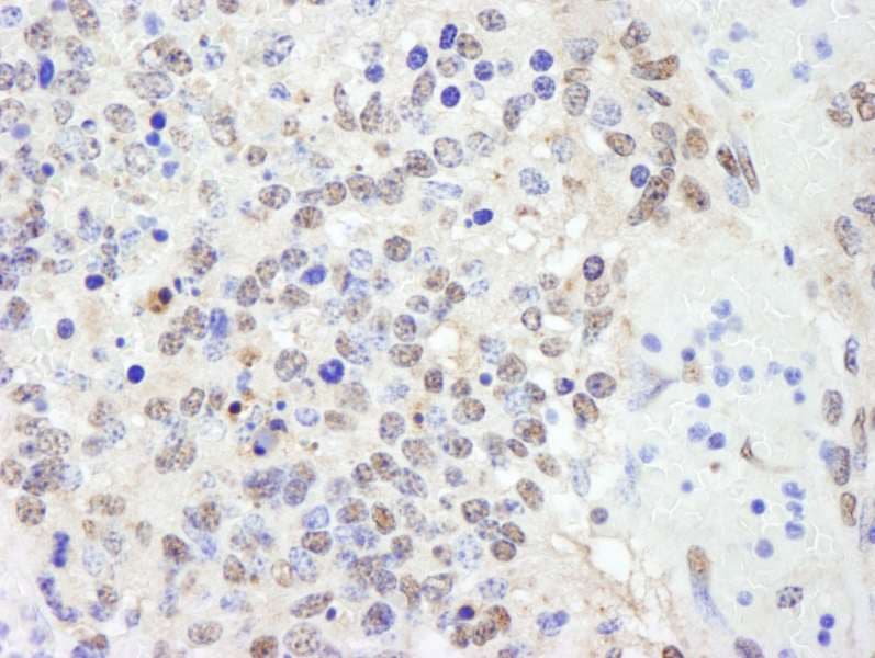 Polyclonal Rabbit anti-Human CHD8 Antibody (aa2252-2302, IHC)