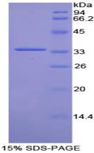 Rat TOR3A Protein (Recombinant His-T7)