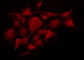 Polyclonal Rabbit anti-Human SIAH2 Antibody (IHC, IF, WB)