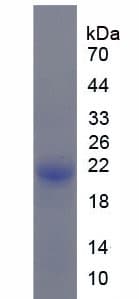Mouse c-Kit / CD117 Protein (Recombinant His)