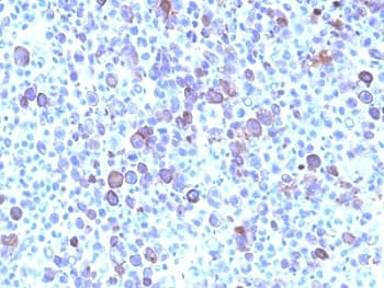 GPC3 / Glypican 3 Antibody (aa511-580, clone SPM595)