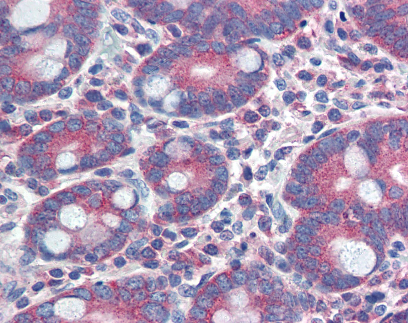 YAP / YAP1 Antibody (aa351-400)