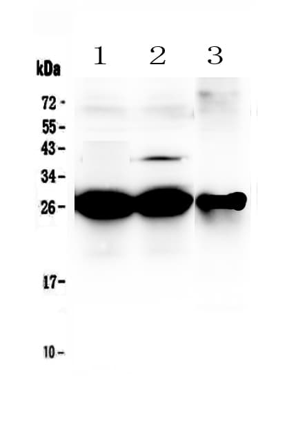 Polyclonal Rabbit anti-Rat MBL2 / Mannose Binding Protein Antibody (IHC, WB)