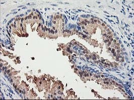 ACSS2 / ACAS2 Antibody (clone OTI2C6)