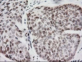 CRY2 Antibody (clone OTI1H5)