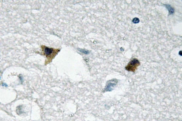 GRB10 Antibody (Leu63)