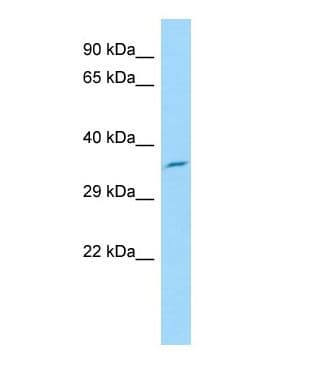 GLT1D1 Antibody (N-Terminus)