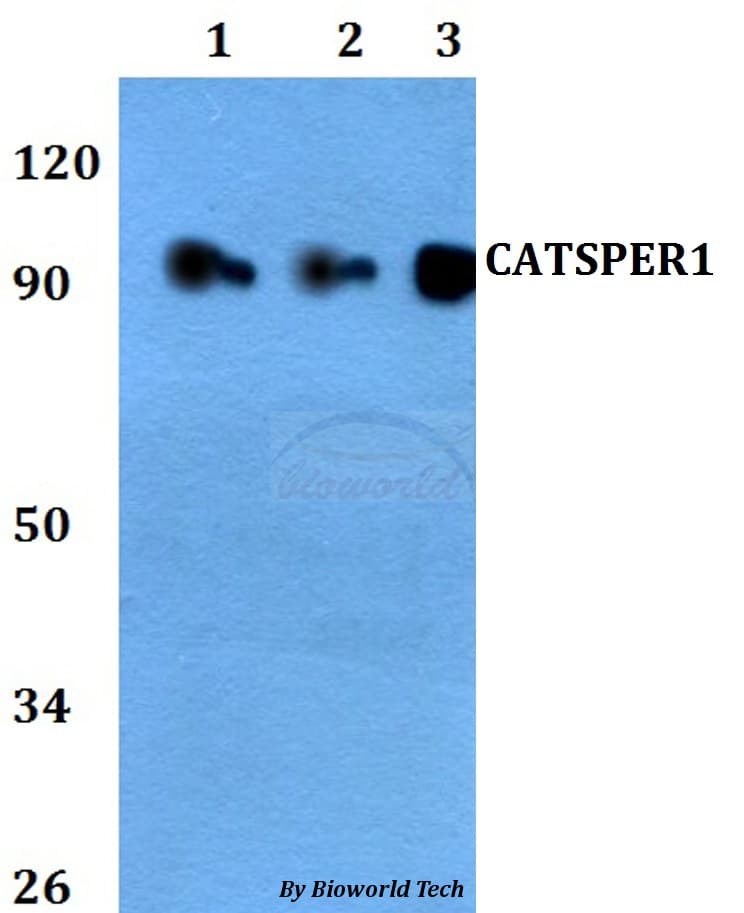 Polyclonal Rabbit anti-Human CATSPER1 / CATSPER Antibody (WB)