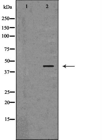 SERPINB5 / Maspin Antibody