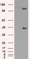 LOX / Lysyl Oxidase Antibody (clone OTI8G5)