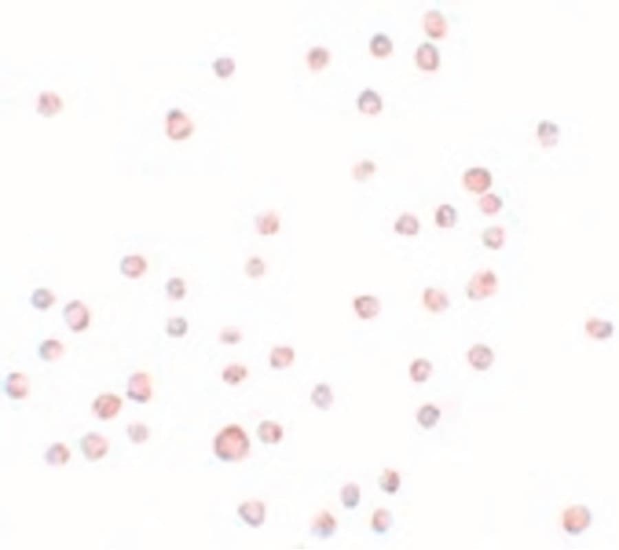 IHC-plus™ Polyclonal Chicken anti-Human KLHL25 Antibody (IHC, IF, WB)
