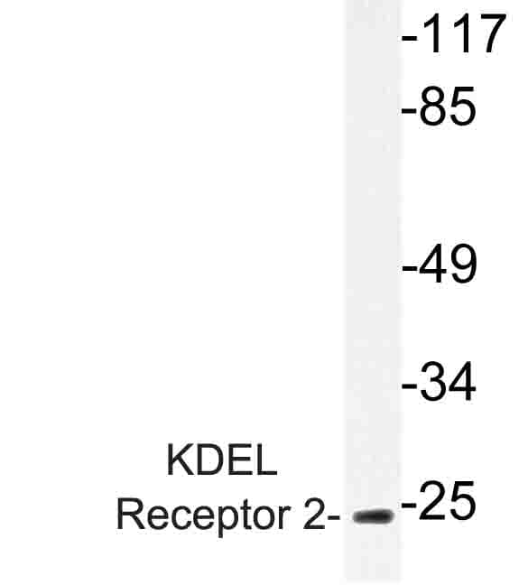 IHC-plus™ KDELR2 Antibody (aa100-150)