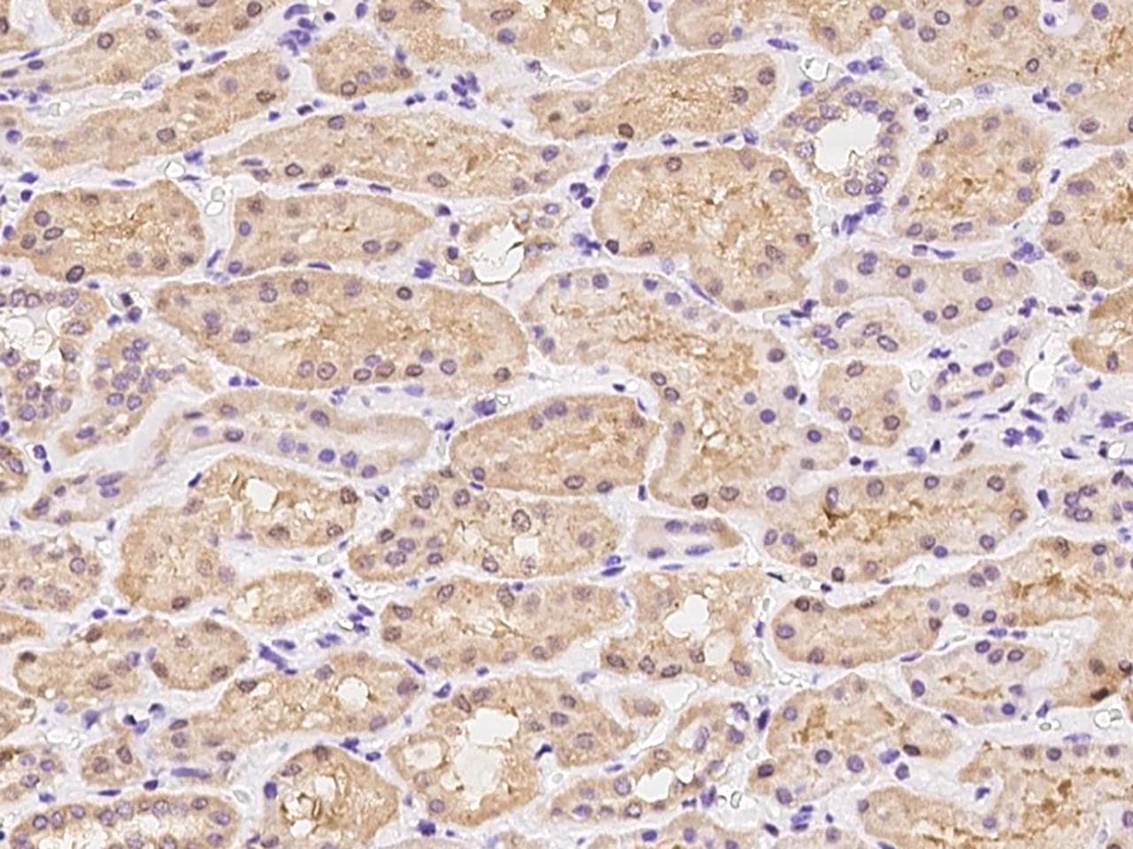 TSSC1 Antibody