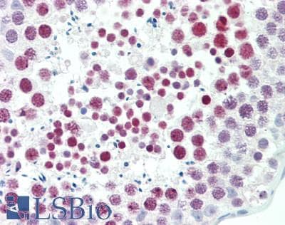 IHC-plus™ Polyclonal Rabbit anti-Human UIMC1 / RAP80 Antibody (aa600-650, IHC, WB)