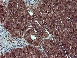Placental Lactogen Antibody (clone OTI2G4)