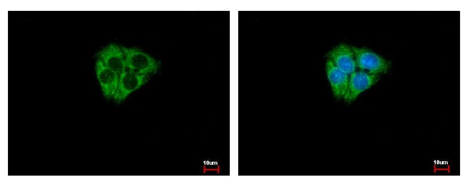 DCLK2 / DCAMKL2 Antibody (aa187-522)