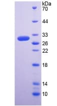 Human RGN / Regucalcin Protein (Recombinant His-T7)