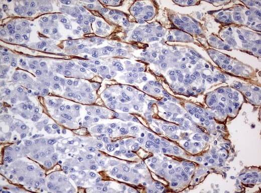 PECAM-1 / CD31 Antibody (clone UMAB31, Carrier-free)