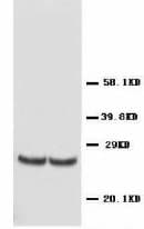 TIMP4 Antibody (C-Terminus)